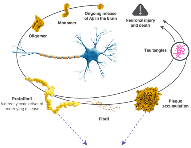 Infographic showing how LEQEMBI clears amyloid plaque and protofibrils